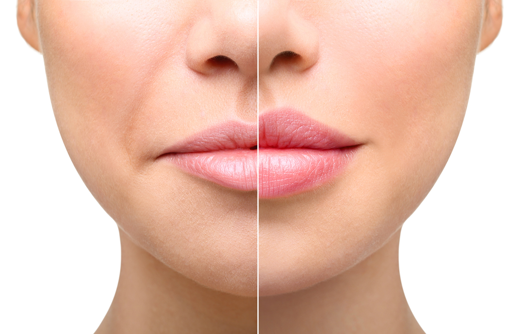 左右異なる顔が配置されたほうれい線をチェックする写真