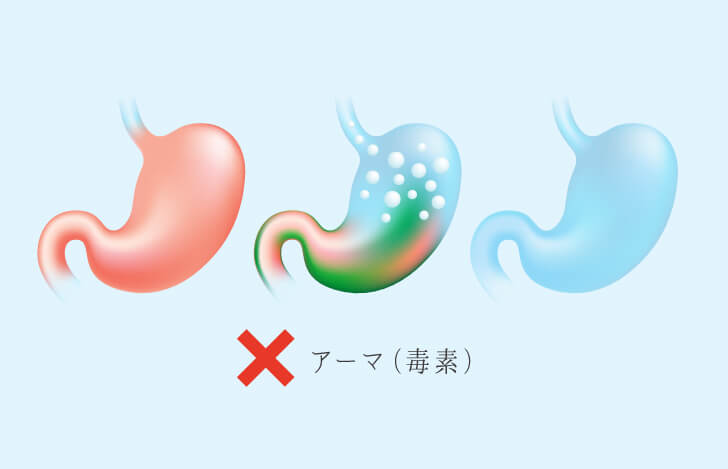 胃腸に溜まったアーマ(毒素)