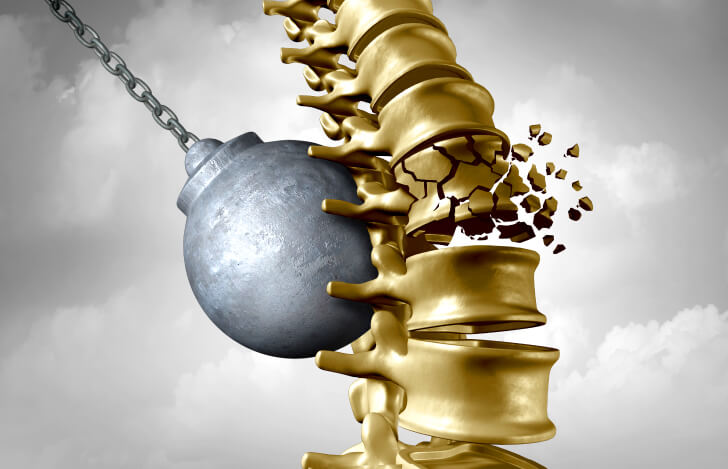 脊柱に鉄の訛りがぶつかる